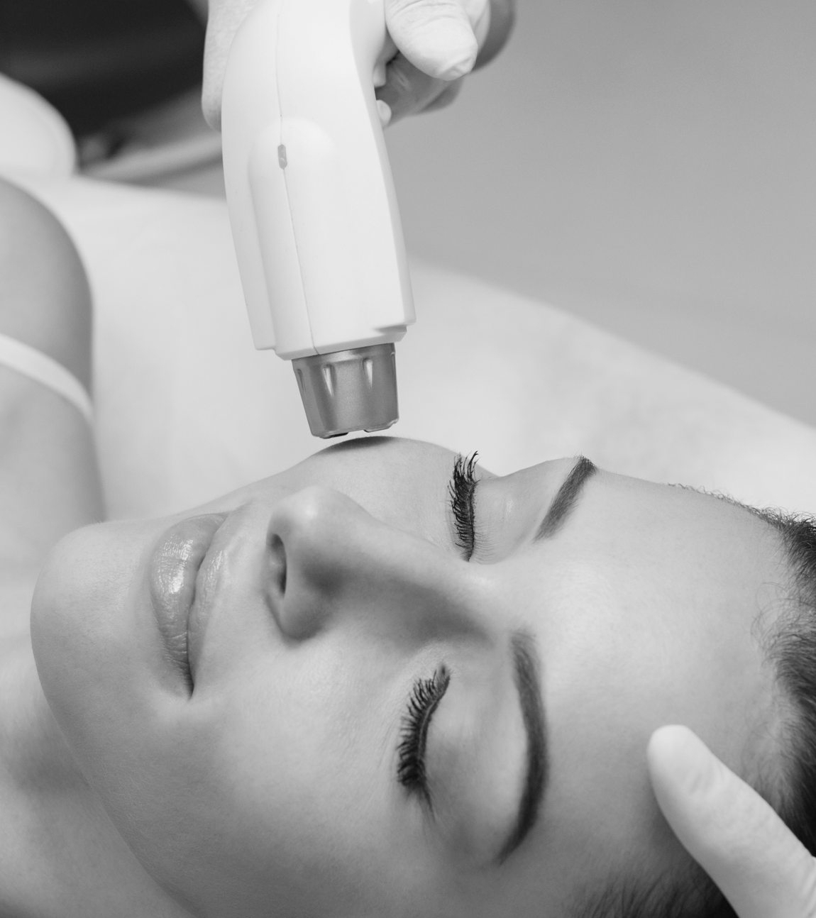 Laser Hair Treatment