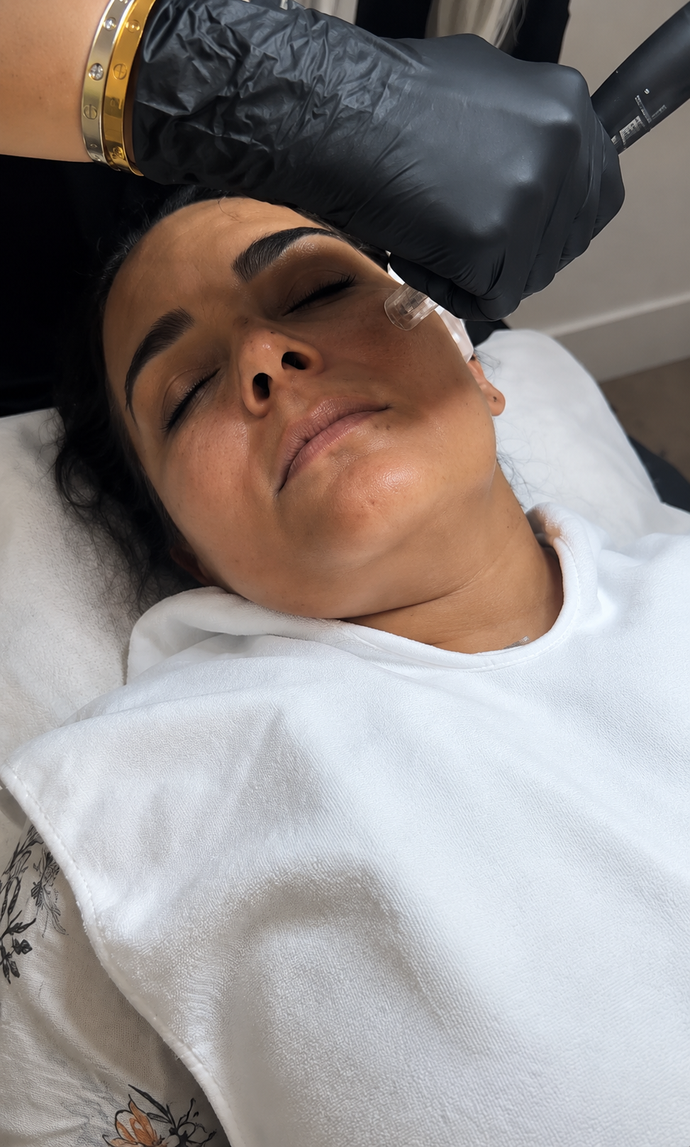 Skin Rejuvenation